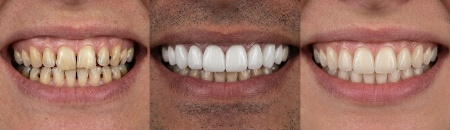 ������ ����� � ����� ����� ��� �����������: �������� � ����� ������ �����������. ���. 6