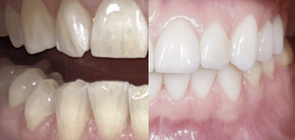 ����� �� ��� ������ ������